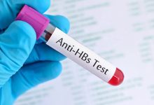 Anti HBs Testi Nedir?
