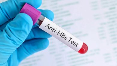Anti HBs Testi Nedir?