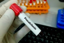 PCT (Prokalsitonin) Nedir? Zararlı mıdır?