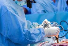 Anjiyo Nedir? Nasıl Yapılır?