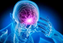 Epilepsi Nedir Belirtileri ve Tedavi Yöntemleri