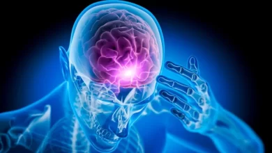 Epilepsi Nedir Belirtileri ve Tedavi Yöntemleri