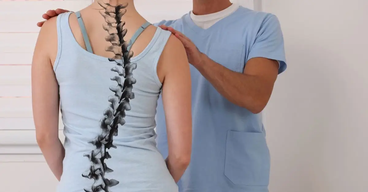 Skolyozun Belirtileri Nelerdir?