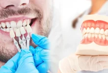 Zirkonyum Kaplama Nedir?