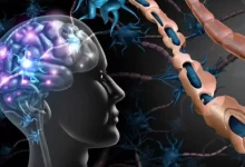 MS Hastalığı Nedir