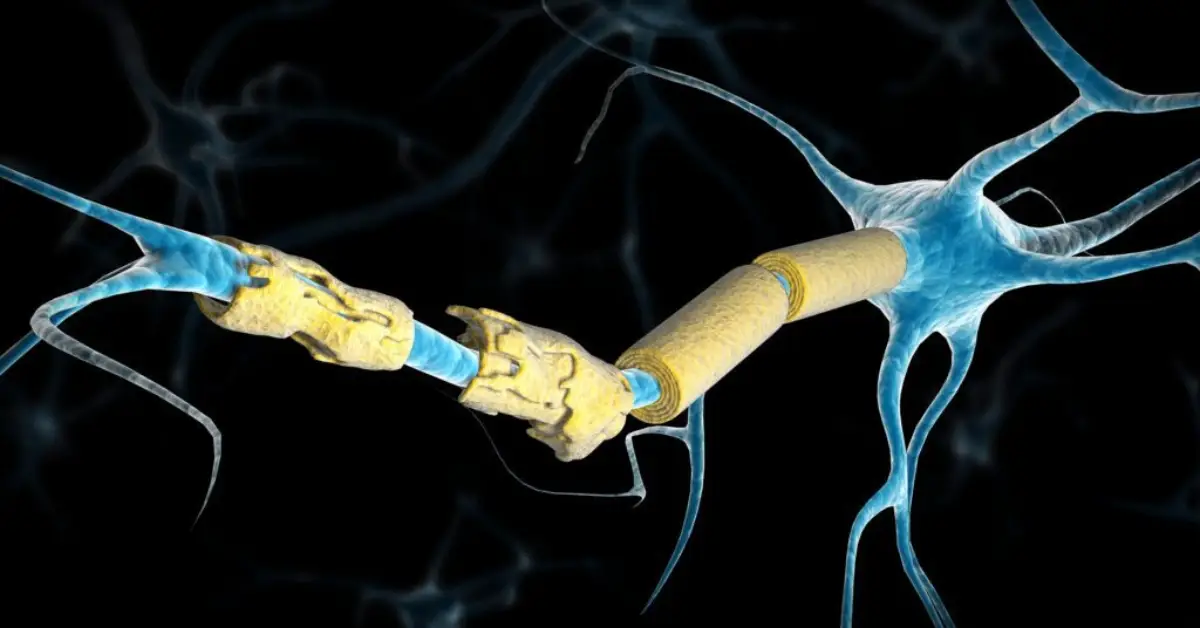 MS Hastalığı Tedavisi Nasıldır?